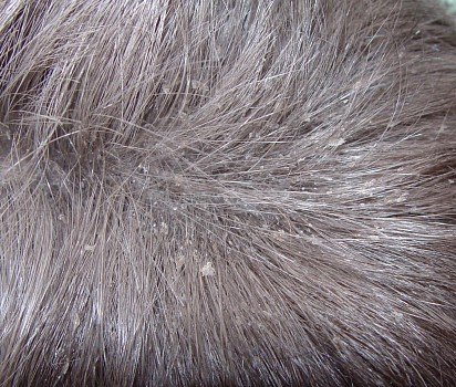 Cat dandruff photo